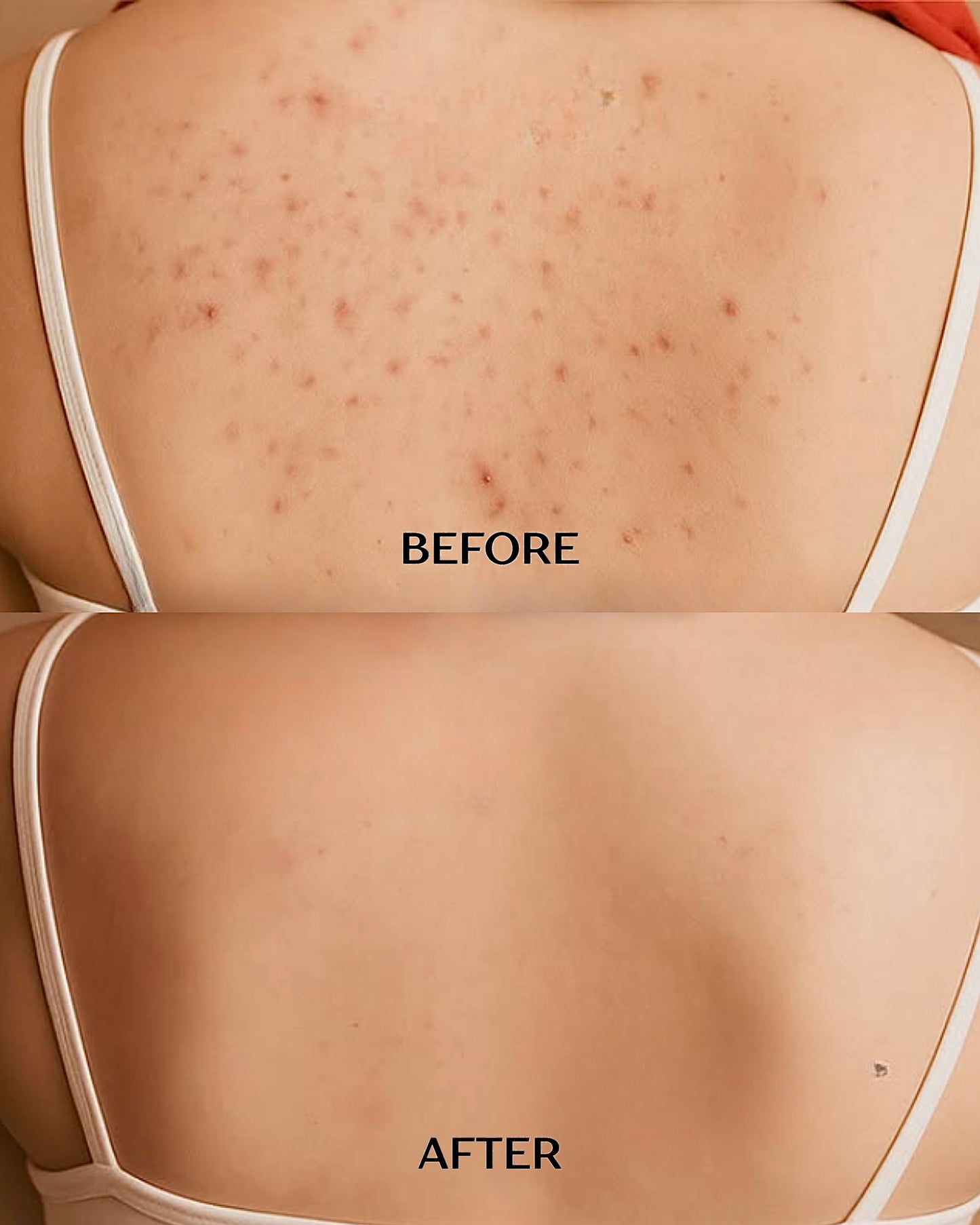 Glycolic Acid And Kojic Acid Body Wash For Dull & Acne-Prone Skin
