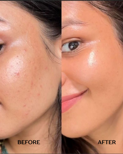 Derma Grain Powder Face Wash for bright and clear skin